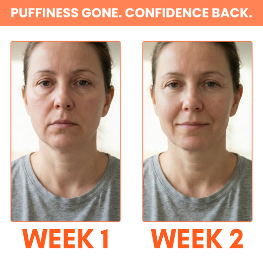 The Lymphatic Facial Brush